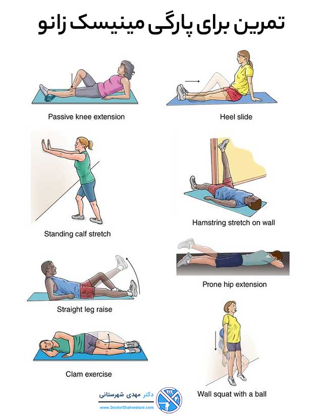 8 تمرین ورزشی برای پارگی منیسک زانو دکتر مهدی شهرستانی