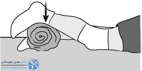 تمرین انقباض عضله چهارسر برای آرتروسکوپی زانو