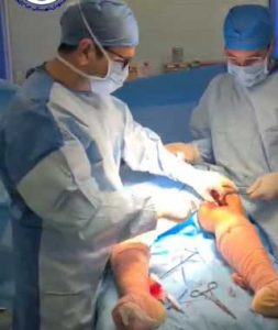 جراحی پای ضربدری(ژنووالگوم)