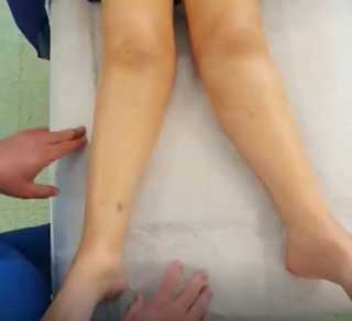 بیمار در حال جزاحی توسط دکتر شهرستانی با زانوی ضربدری و رماتیسم مفصلی